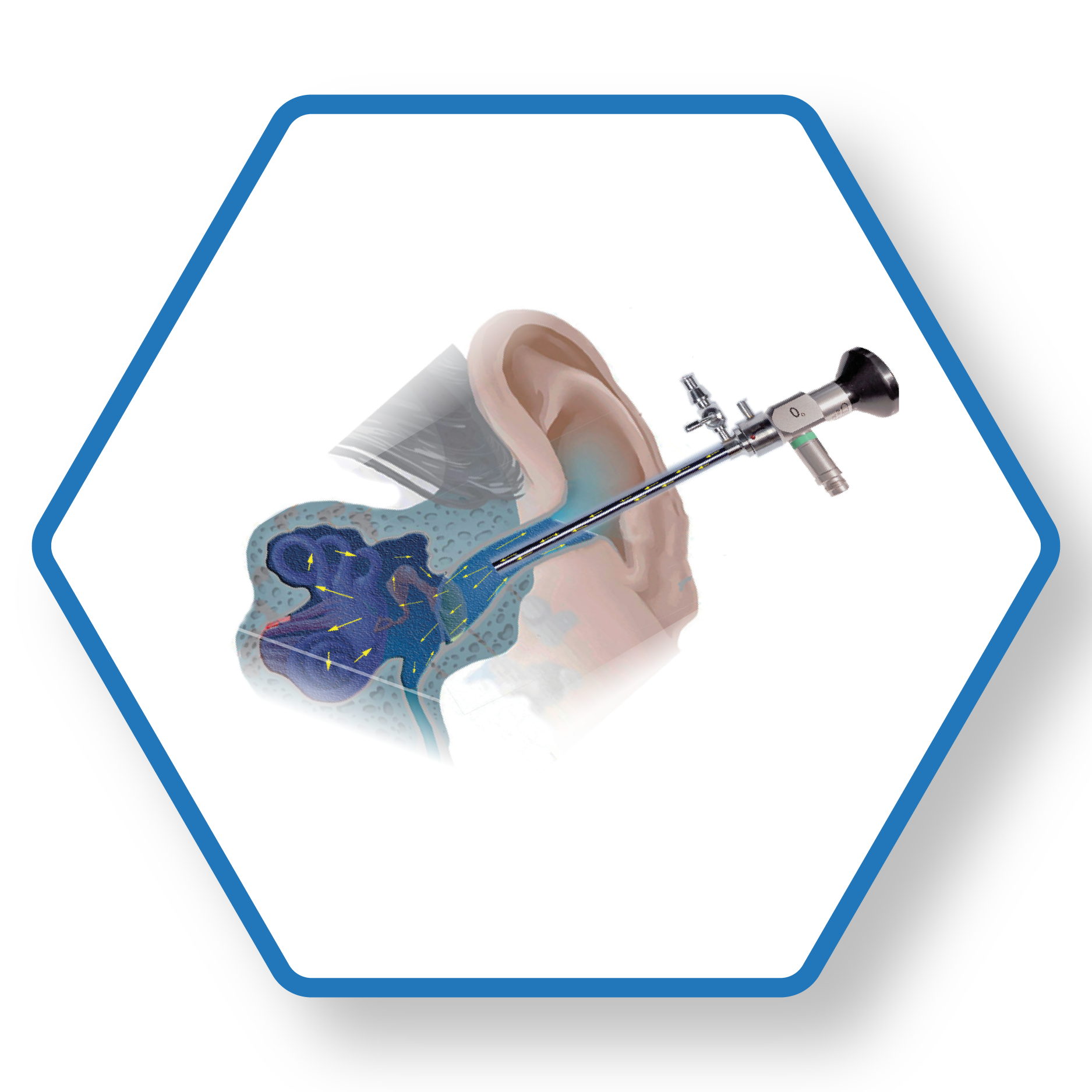 Nội Soi Tai Dưới Nước